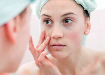 Kako odpraviti podočnjake?