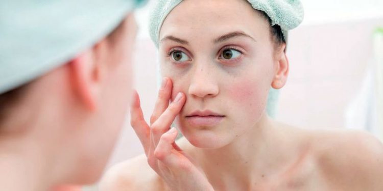 Kako odpraviti podočnjake?